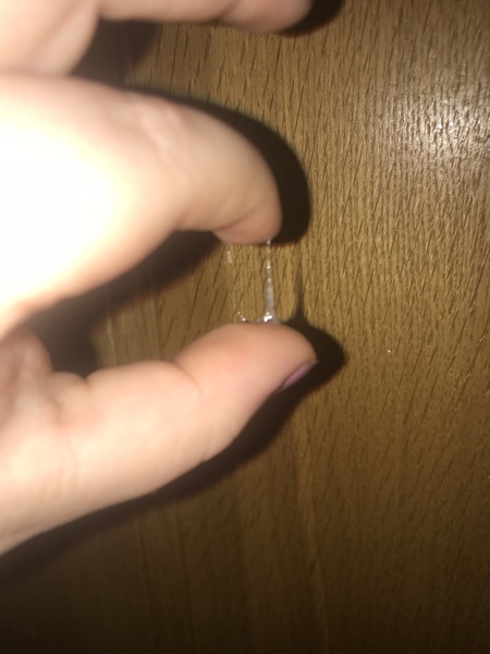 Need help!! (Tmi pic attached)