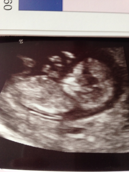 The March-ers 2019 #4