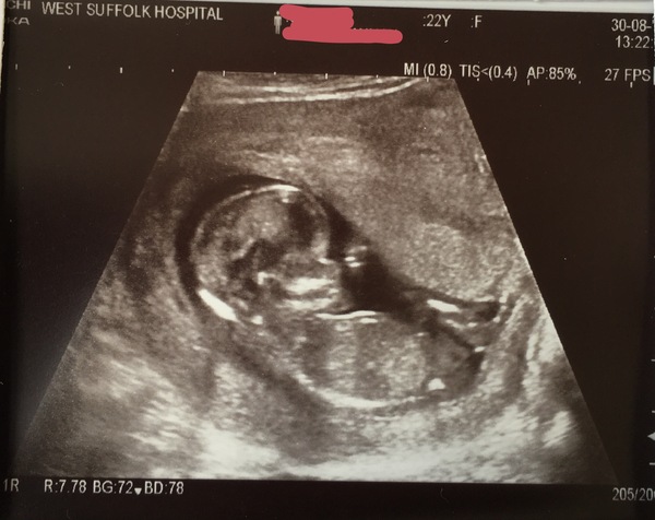 Any gender guesses?