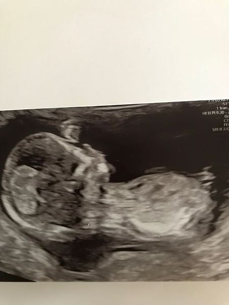 Girl or boy?