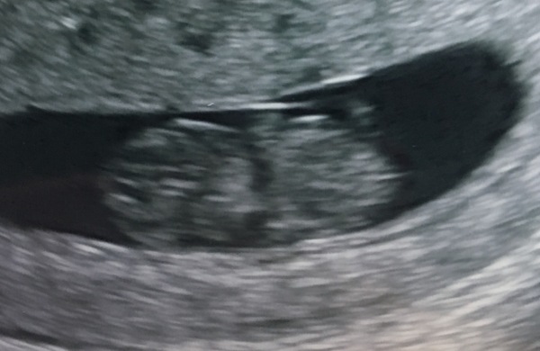 The March-ers 2019 #4