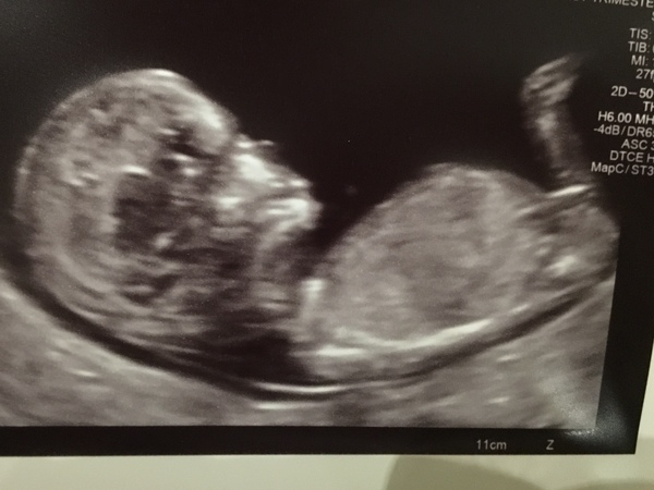 Guess the gender!
