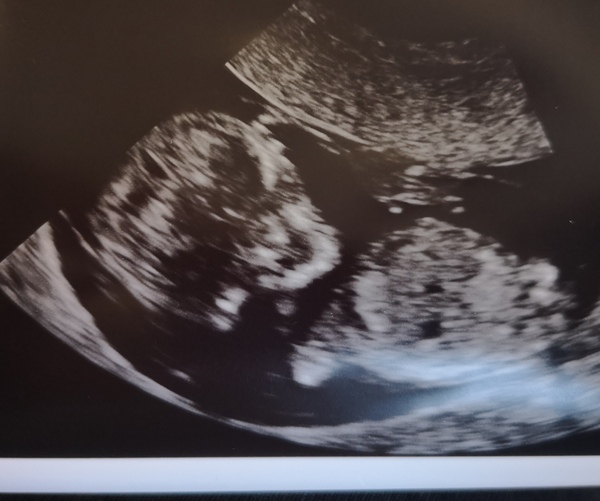 The March-ers (2019) #3