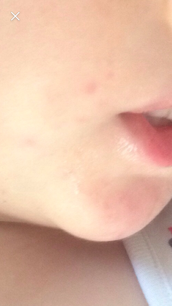 Dd spots