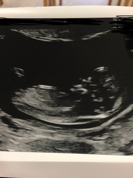 Gender guesses?