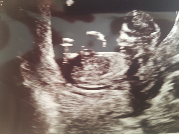 Girl or boy? Sorry for another one of these!