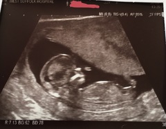 Any gender guesses?