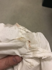37+2 does this look like my mucous plug?