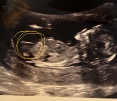 Guess the sex...