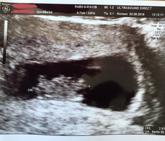 Fresh Start thread for pregnancy after miscarriage or loss