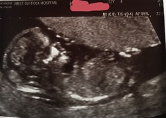 Any gender guesses?