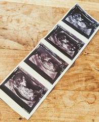 Gender guesses pretty please