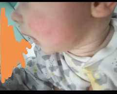 Is this teething? (Pics attached)