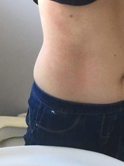 Rash - what is it? Pics included!