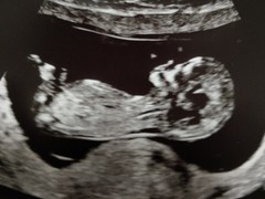 The March-ers 2019 #4