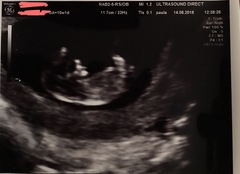 14 weeks and not feeling pregnant anymore
