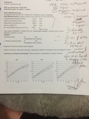 IUGR and induction