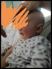 Is this teething? (Pics attached)
