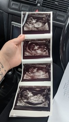 Gender guesses pretty please