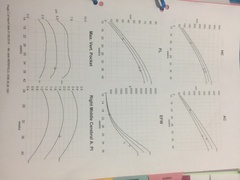 IUGR and induction