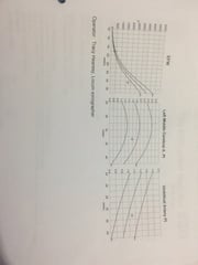 IUGR and induction