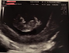 14 weeks and not feeling pregnant anymore