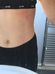 Rash - what is it? Pics included!