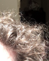 Hair not growing. At wits end.