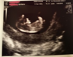 First pregnancy, looking for buddies..