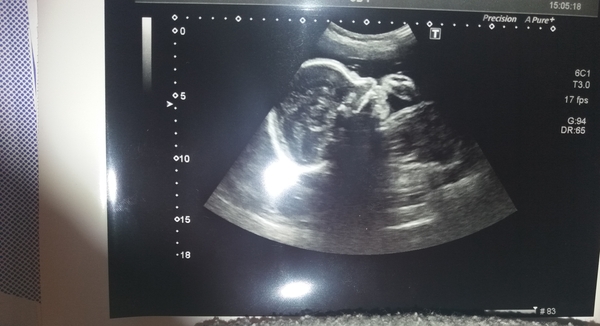 December 2018 Babies - Thread #4