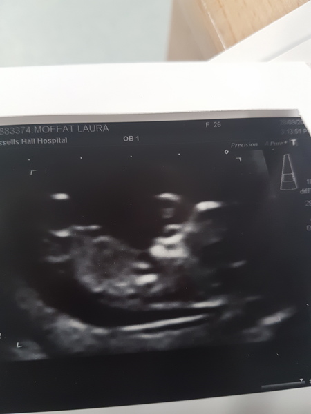 First babies due in April