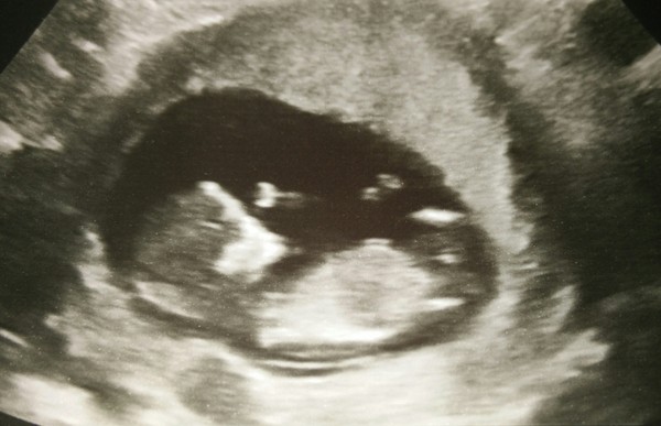 The March-ers 2019 #5