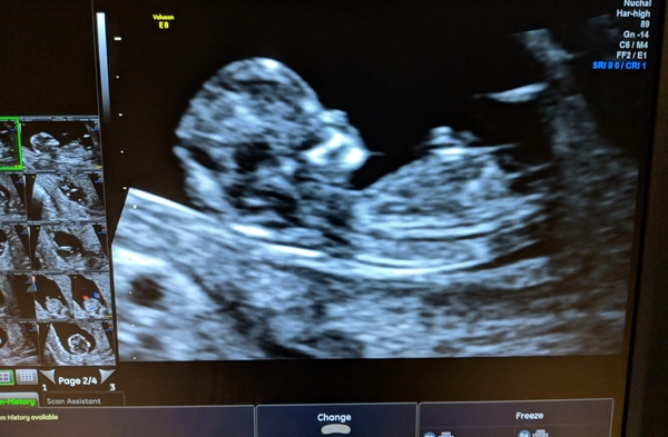 Guess the sex? (just for fun)