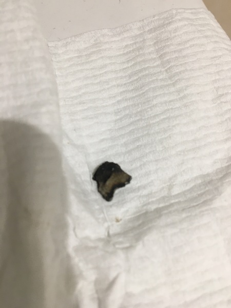 DENTAL ADVICE NEEDED - what do I need to do tonight???