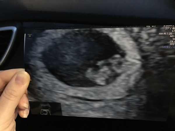 First babies due in April