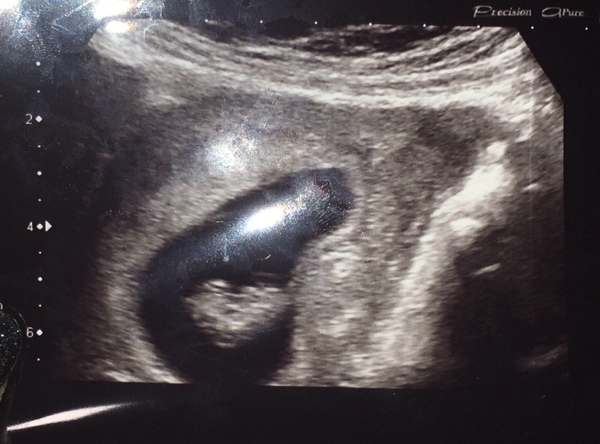 May-ish 2019 - thread 2!