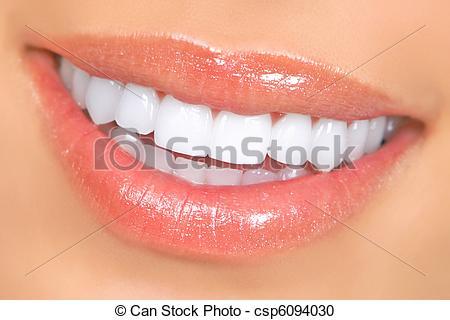 17 year old DS wants a better smile - any dentists on here?