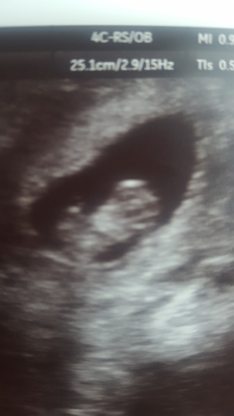 The March-ers 2019 #5