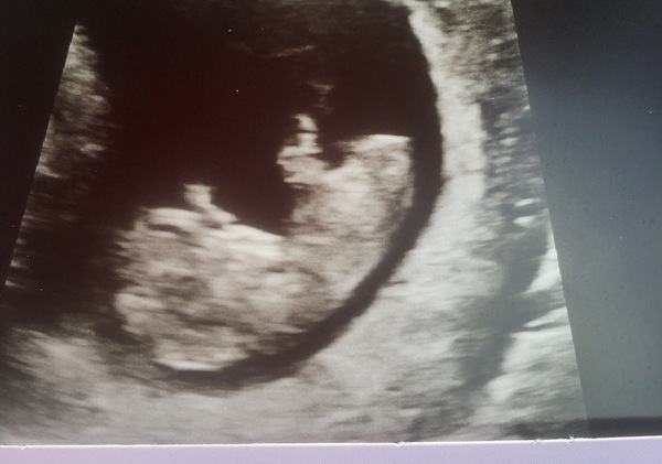 The March-ers 2019 #5