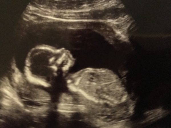 The March-ers 2019 #5