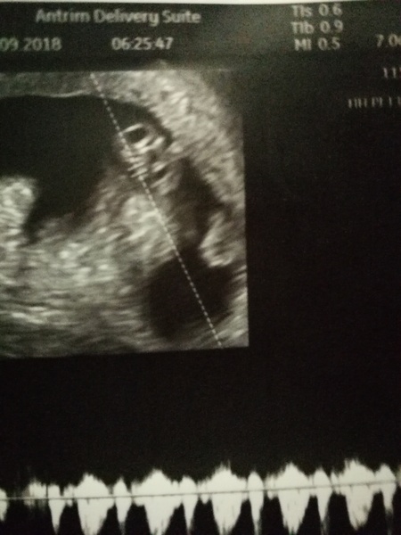 May-ish 2019 - thread 2!