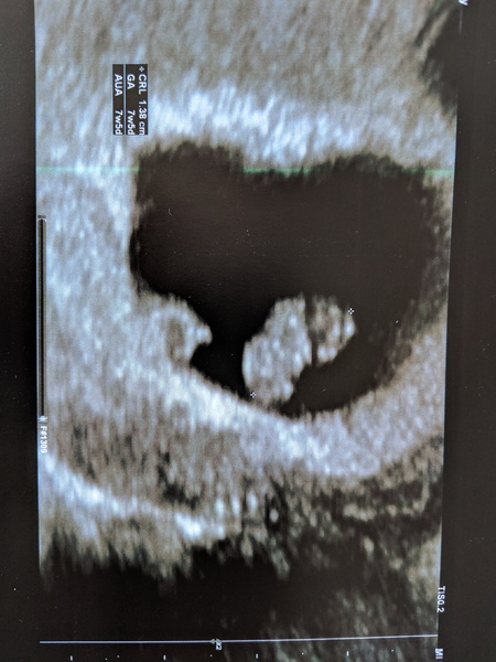 Due May 2019