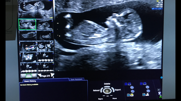 The March-ers 2019 #5