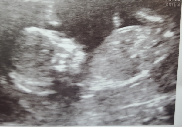 The March-ers 2019 #5