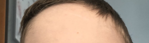 Has anyone else’s Child split head open