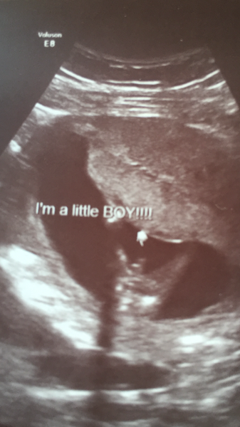 Gender Guesses!!?? 💗💙