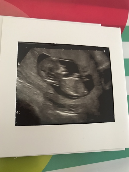 The March-ers 2019 #5