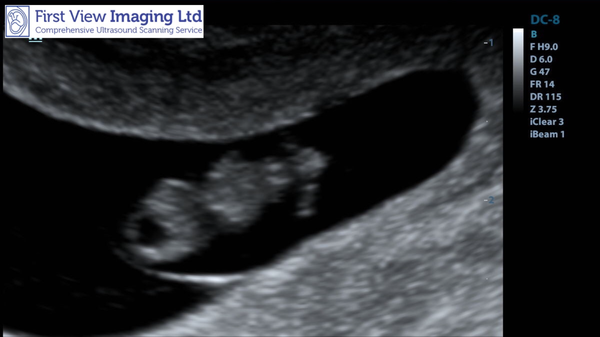 May-ish 2019 - thread 2!