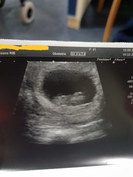 Early scan