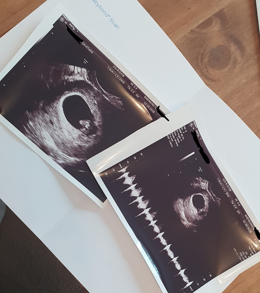 First babies due in April